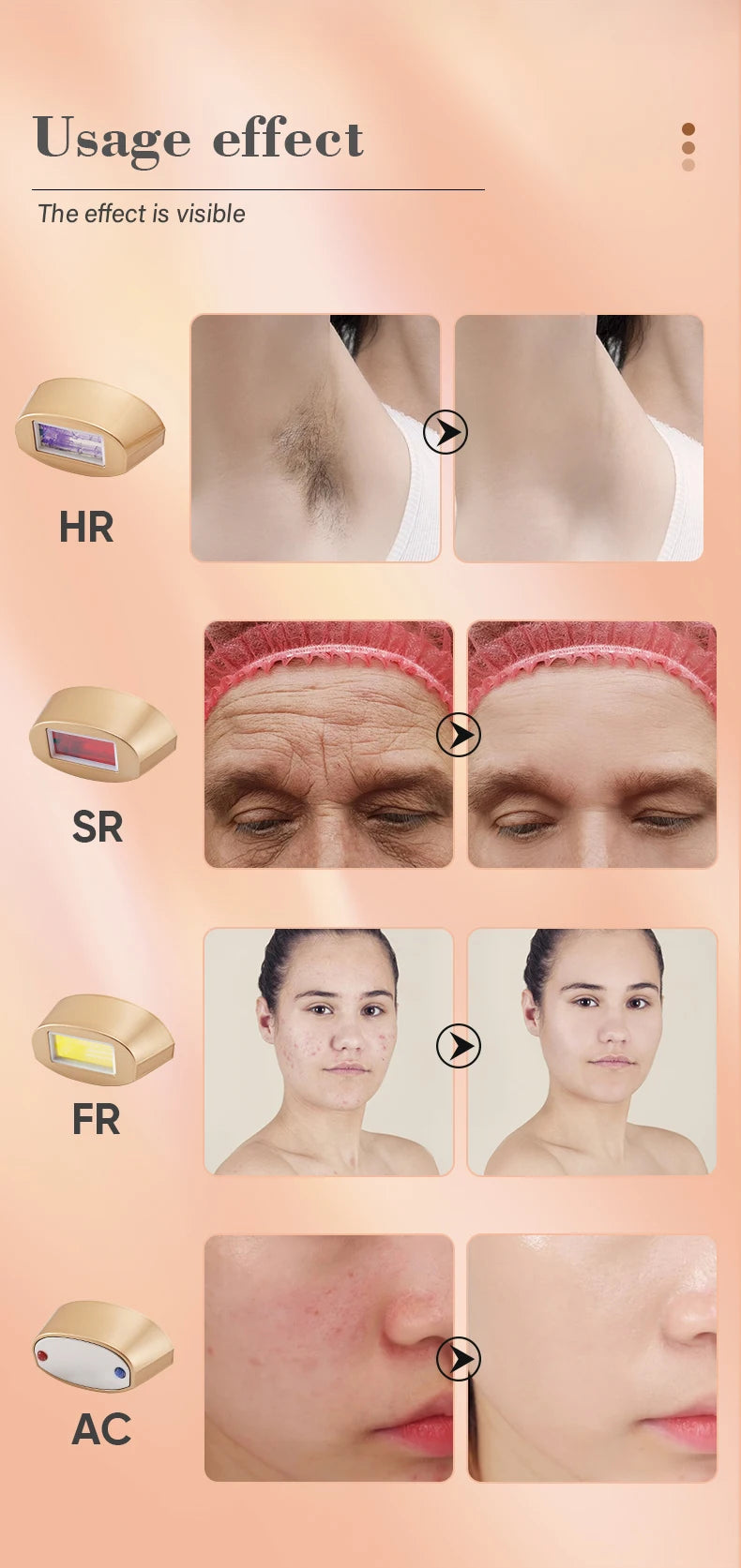Épilateur laser IPL KODO A113 – 4 en 1 indolore, visage & corps, 900k flashs