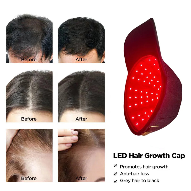 Casque LED croissance capillaire – 96 diodes, 660nm & 850nm, repousse cheveux